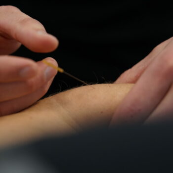 Behandeling met dry needling